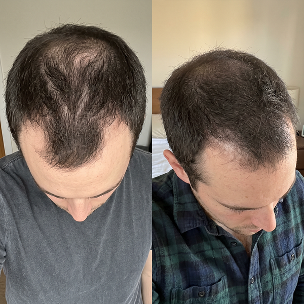 JOSH T, 32 before