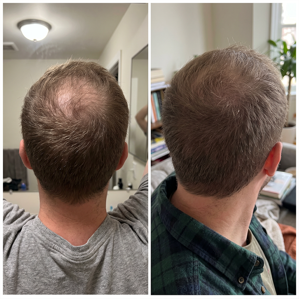 NATHAN C, 39 before