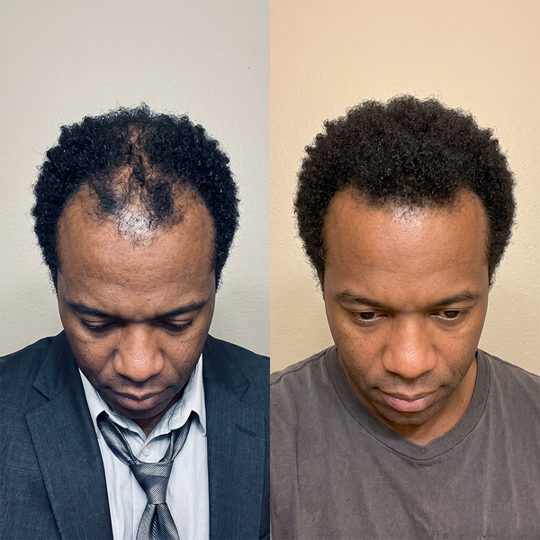 ALI C, 46 before