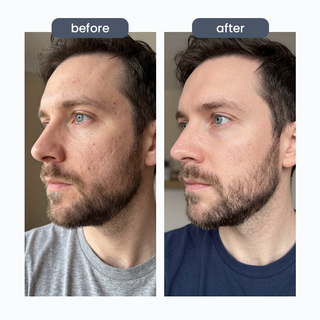 GHK-Cu Peptides + Hyaluronic Serum
