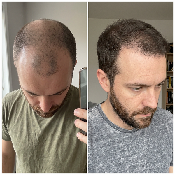 Daniel W, 37 before