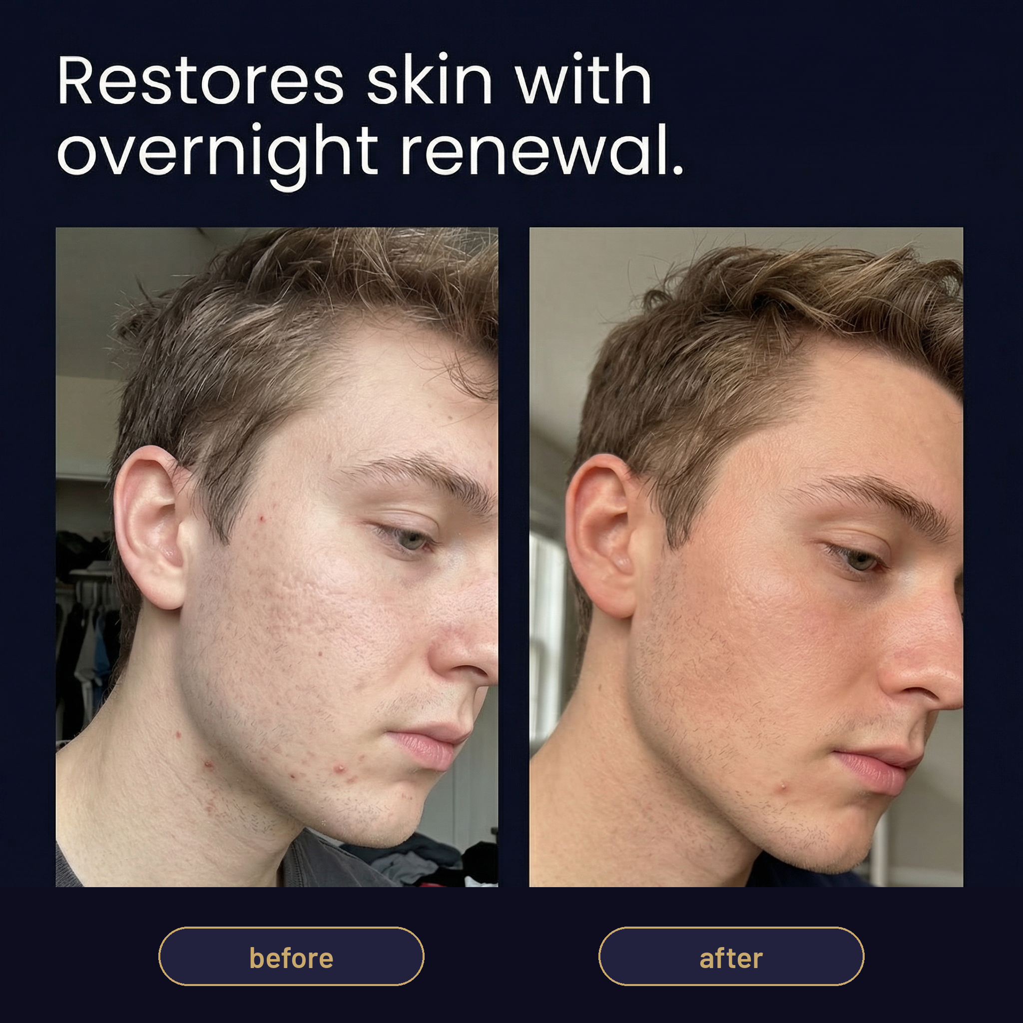 GHK-Cu Peptides + Hyaluronic Serum